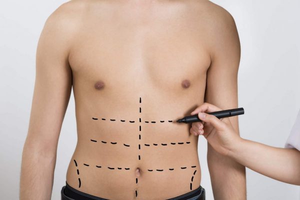 تکنیکهای پیشرفته لیپوماتیک برای بهبود زیبایی پوست و مو